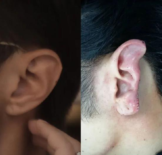 捕获.PNG